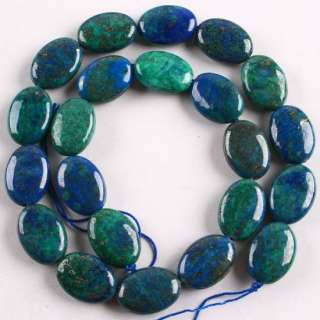 18 x 13mm Rare Azurite Malachite Flat Oval Loose Beads  