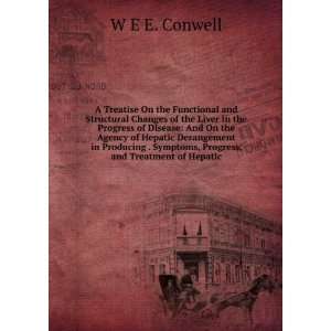   Symptoms, Progress, and Treatment of Hepatic W E E. Conwell Books