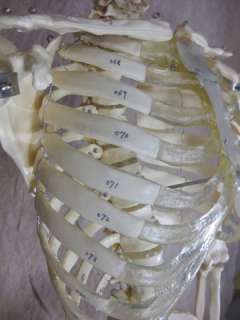 Our Numbered Budget Bucky Skeleton is the same as item 1st Class 
