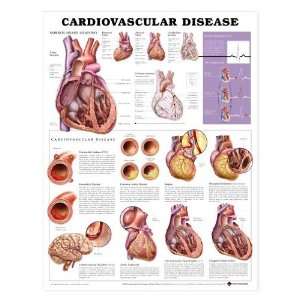  Cardiovascular Disease Anatomical Chart Industrial 