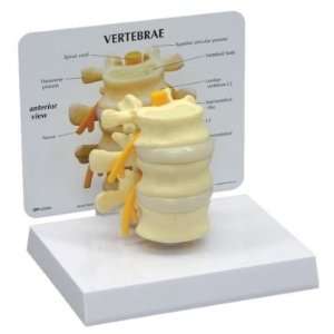  3 Piece Human Vertebrae L2,L3 & L4 Anatomy Model #1500 